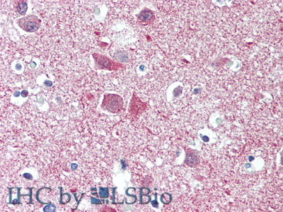 Polyclonal Antibody to Synaptopodin (SYNPO)