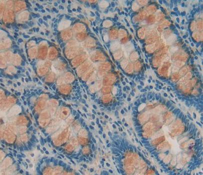 Polyclonal Antibody to Deoxyhypusine Synthase (DHPS)