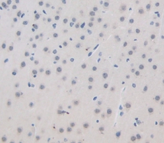 Polyclonal Antibody to Glutamate Decarboxylase 1, Brain (GAD1)