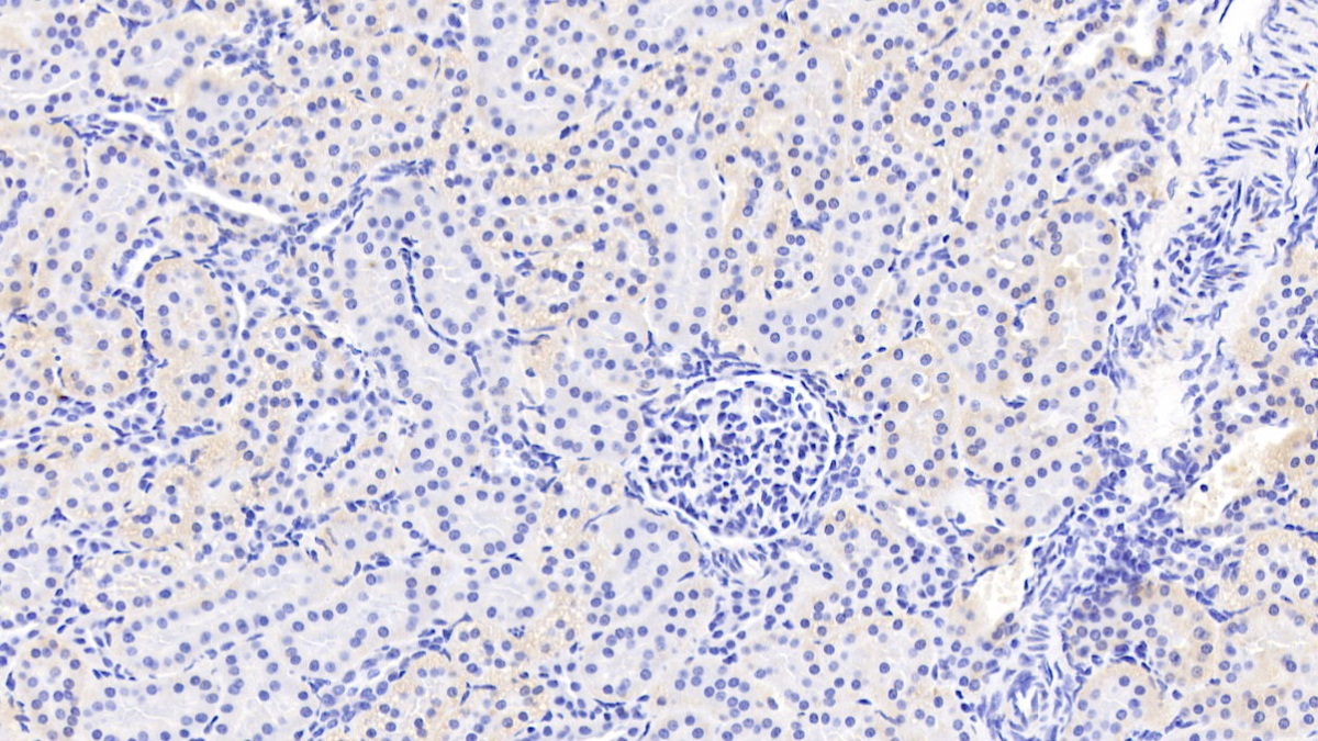 Polyclonal Antibody to Platelet Derived Growth Factor C (PDGFC)