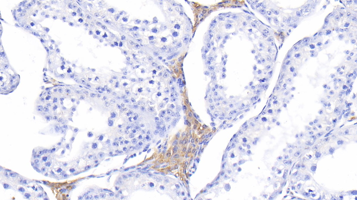 Polyclonal Antibody to Melatonin Receptor 1A (MTNR1A)