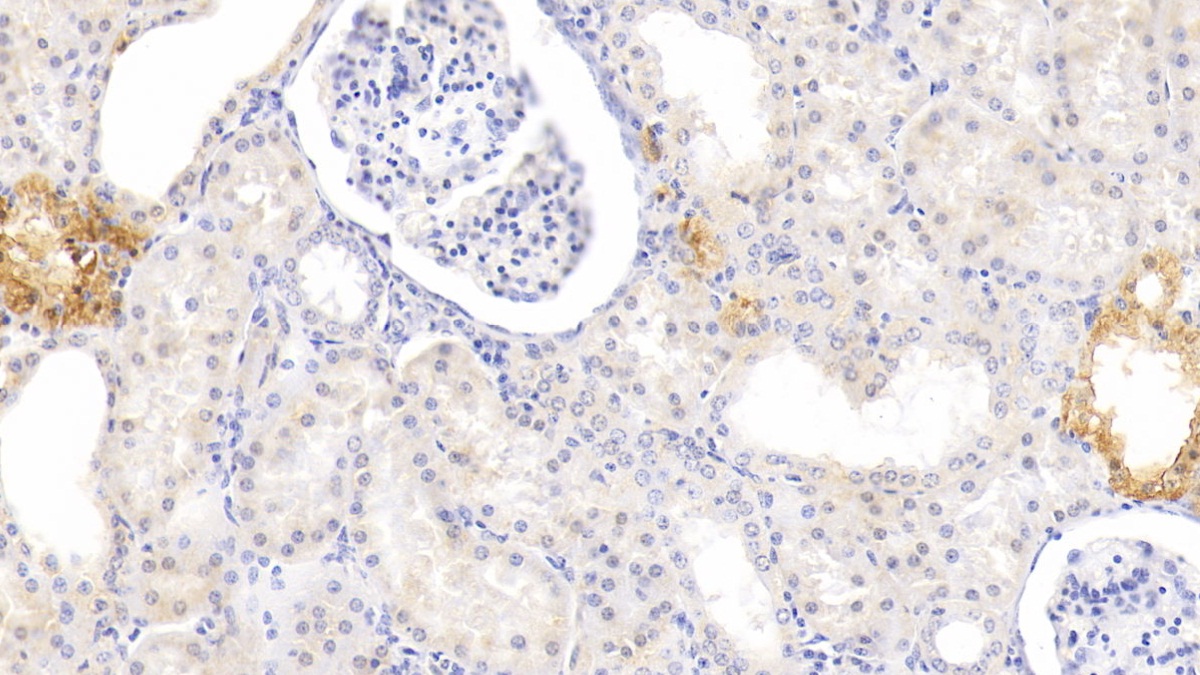 Polyclonal Antibody to Melatonin Receptor 1A (MTNR1A)