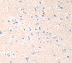 Polyclonal Antibody to Cathepsin B (CTSB)