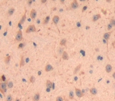 Polyclonal Antibody to Crystallin Gamma F (CRYgF)