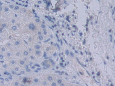 Polyclonal Antibody to Tyrosyl tRNA Synthetase (YARS)