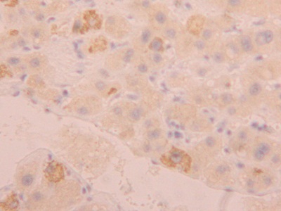 Polyclonal Antibody to Fibrinogen Like Protein 1 (FGL1)