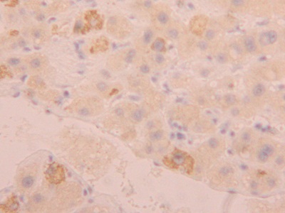 Polyclonal Antibody to Fibrinogen Like Protein 1 (FGL1)