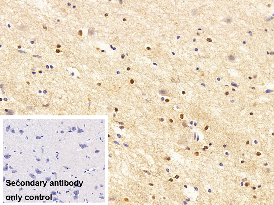 Polyclonal Antibody to Heat Shock 70kDa Protein 2 (HSPA2)