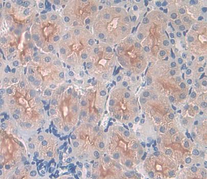 Polyclonal Antibody to Carbonic Anhydrase XII (CA12)