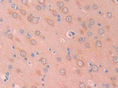 Polyclonal Antibody to Carbonic Anhydrase XII (CA12)