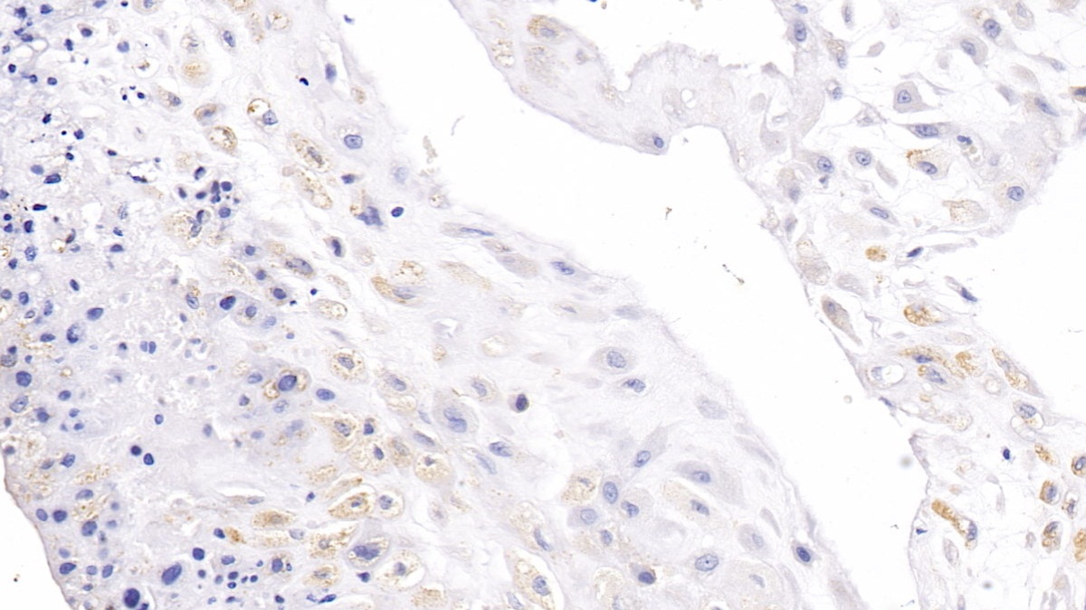 Polyclonal Antibody to Carbonic Anhydrase XIII (CA13)