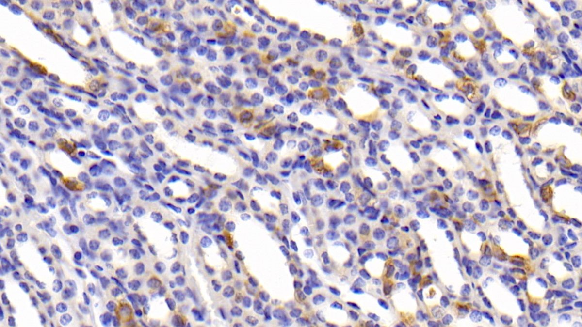 Polyclonal Antibody to Carbonic Anhydrase XIII (CA13)