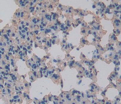 Polyclonal Antibody to Arachidonate-12-Lipoxygenase, 12R Type (ALOX12B)