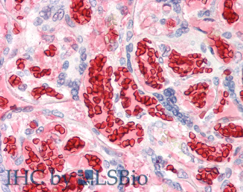 Polyclonal Antibody to Hemoglobin Alpha 1 (HBa1)