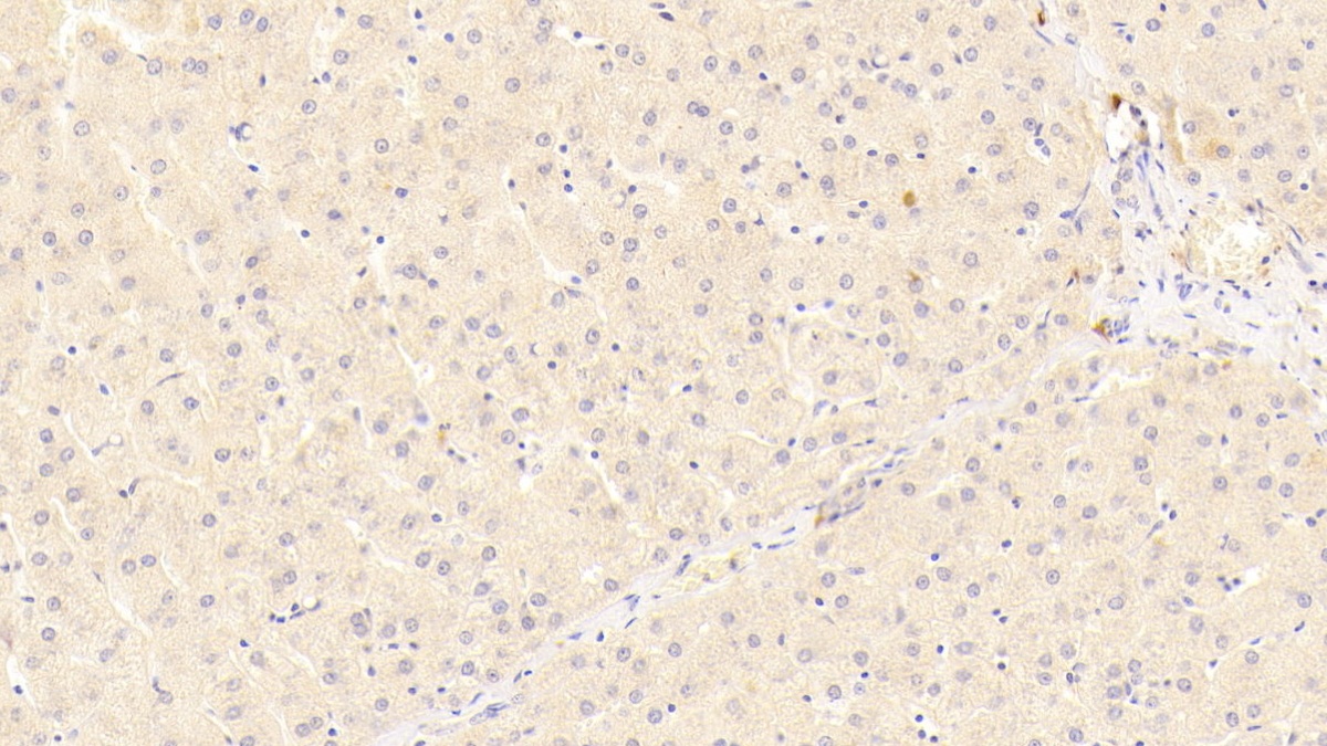 Polyclonal Antibody to Low Density Lipoprotein Receptor Related Protein 5 (LRP5)