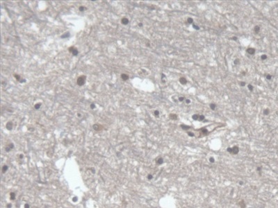 Polyclonal Antibody to Low Density Lipoprotein Receptor Related Protein 1B (LRP1B)