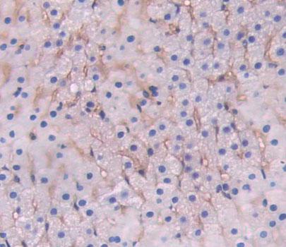 Polyclonal Antibody to Low Density Lipoprotein Receptor Related Protein 1B (LRP1B)