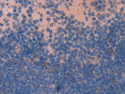 Polyclonal Antibody to Nucleobindin 2 (NUCB2)
