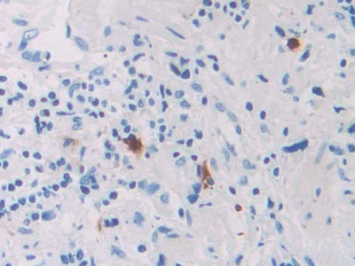 Polyclonal Antibody to Ribonuclease A8 (RNASE8)
