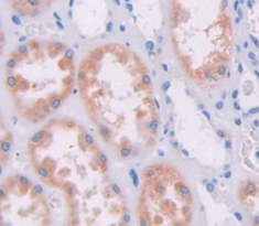 Polyclonal Antibody to Ribonuclease A7 (RNASE7)