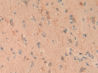 Polyclonal Antibody to Complement Component 1, Q Subcomponent A (C1qA)