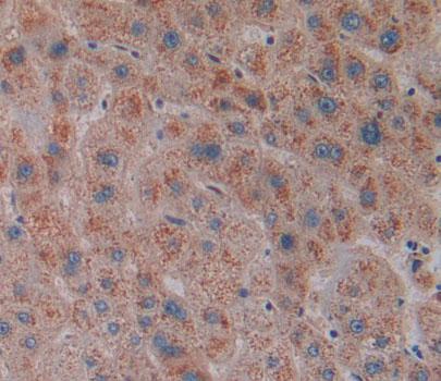 Polyclonal Antibody to Lipase, Monoacylglycerol (MGL)