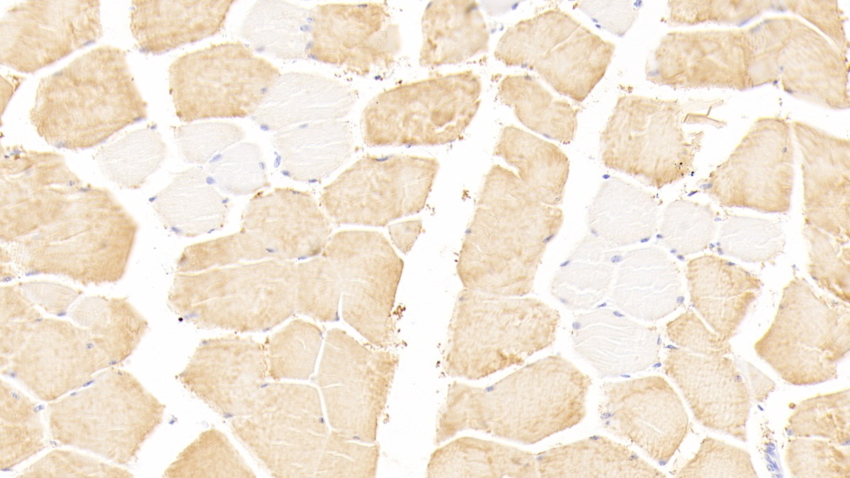 Polyclonal Antibody to Troponin I Type 2, Fast Skeletal (TNNI2)