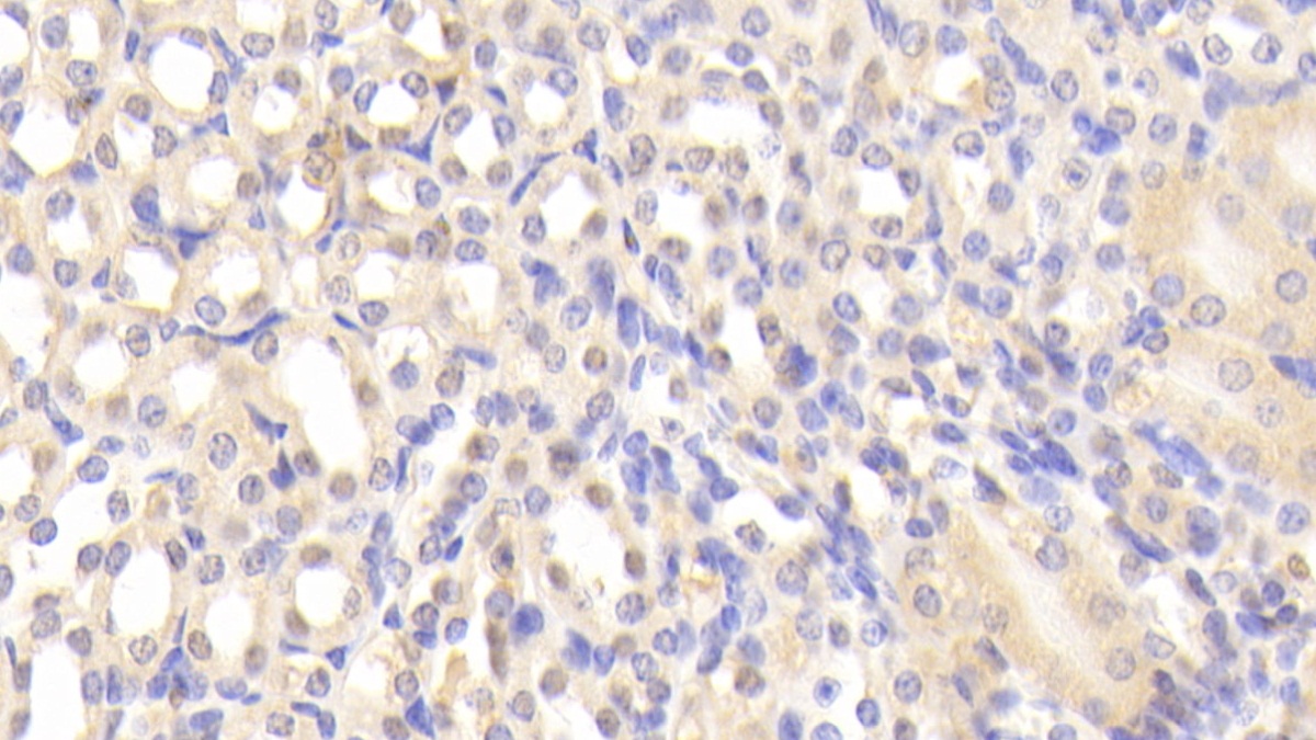 Polyclonal Antibody to Leukotriene A4 Hydrolase (LTA4H)