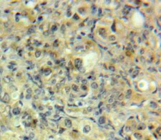 Polyclonal Antibody to G Protein Coupled Receptor Kinase 5 (GRK5)