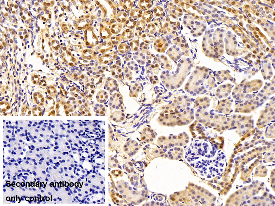 Polyclonal Antibody to Proteasome 26S Subunit, ATPase 1 (PSMC1)