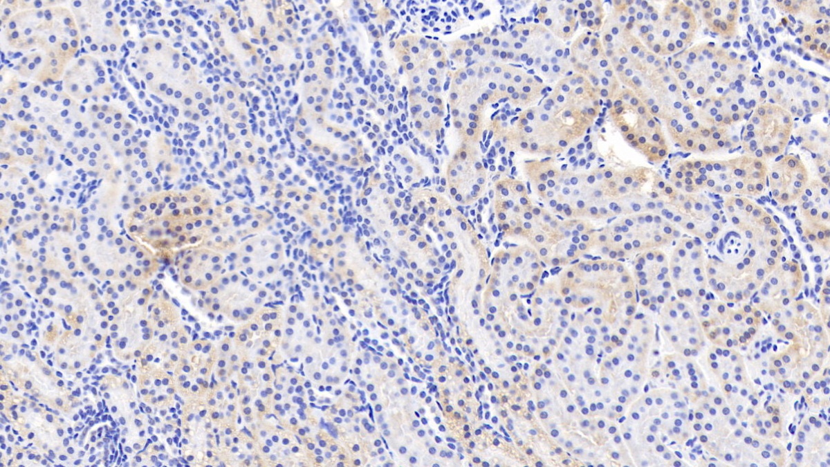 Polyclonal Antibody to Amiloride Sensitive Sodium Channel Subunit Alpha (SCNN1a)