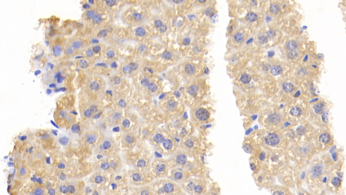 Polyclonal Antibody to Interleukin 17 Receptor B (IL17RB)