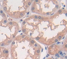Polyclonal Antibody to Slit Homolog 1 (Slit1)