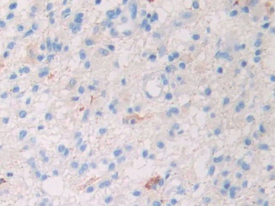 Polyclonal Antibody to Slit Homolog 1 (Slit1)