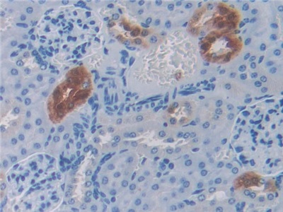 Polyclonal Antibody to Slit Homolog 1 (Slit1)