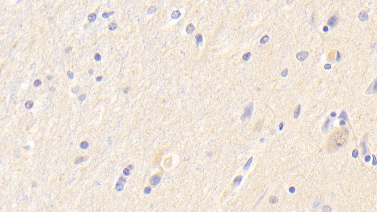 Polyclonal Antibody to Neuroserpin (NSP)