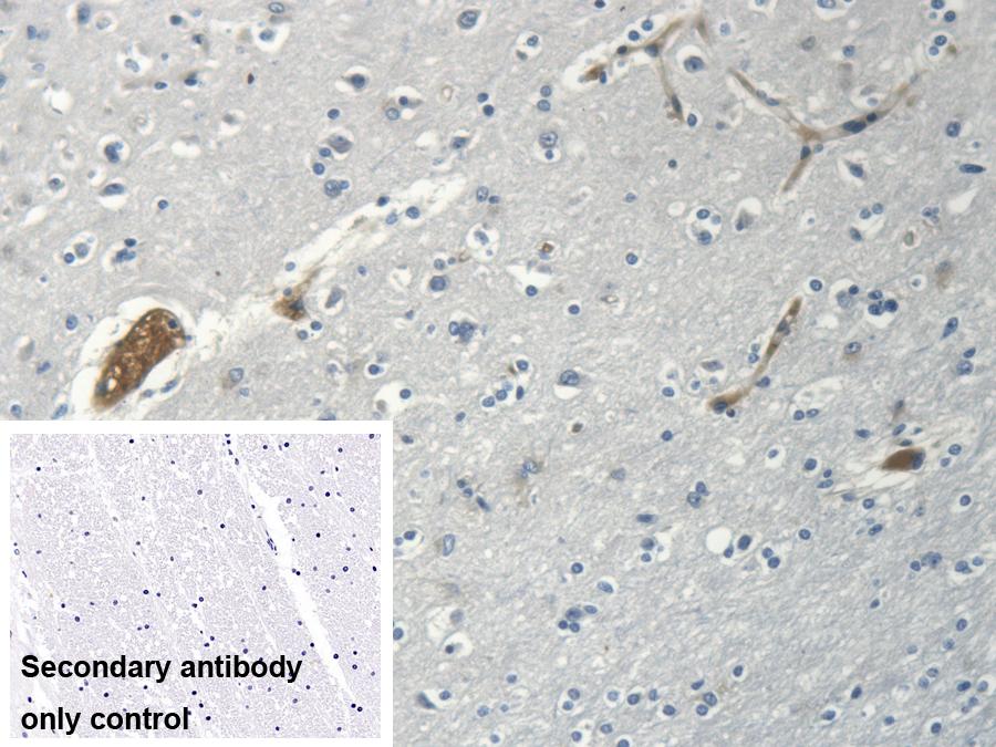 Polyclonal Antibody to Myosin Heavy Chain 14, Non Muscle (MYH14)