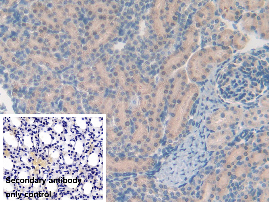 Polyclonal Antibody to Cytochrome P450 27B1 (CYP27B1)