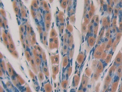 Polyclonal Antibody to Cytochrome P450 24A1 (CYP24A1)