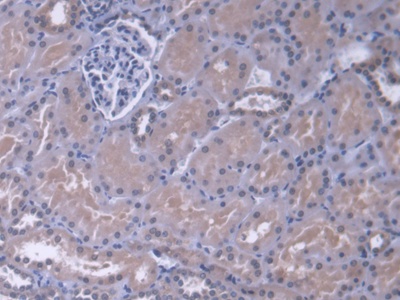 Polyclonal Antibody to Mitogen Activated Protein Kinase 13 (MAPK13)