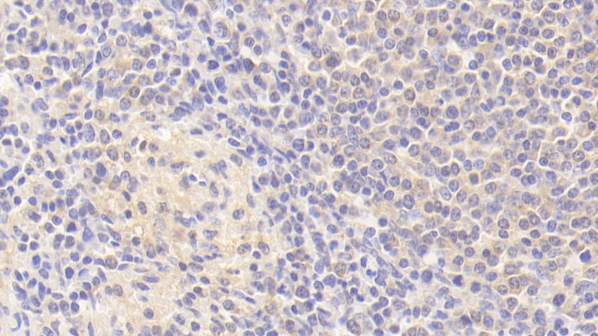 Polyclonal Antibody to Protein Tyrosine Phosphatase, Non Receptor Type 5 (PTPN5)