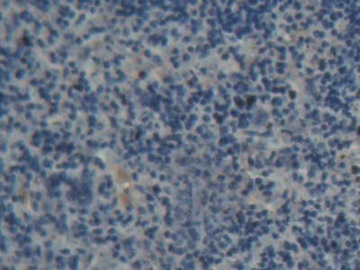 Polyclonal Antibody to ATP Binding Cassette Transporter B8 (ABCB8)