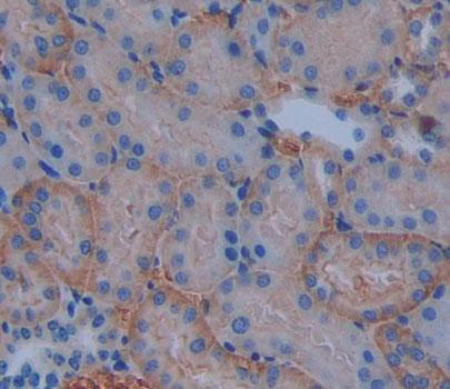 Polyclonal Antibody to ATP Binding Cassette Transporter B10 (ABCB10)
