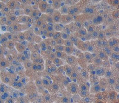 Polyclonal Antibody to Acyl Coenzyme A Oxidase 2, Branched (ACOX2)