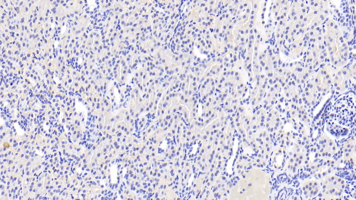 Polyclonal Antibody to Acyl Coenzyme A Synthetase Medium Chain Family, Member 1 (ACSM1)