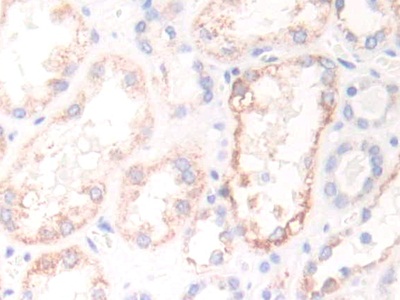 Polyclonal Antibody to Enoyl Coenzyme A Hydratase 1, Peroxisomal (ECH1)