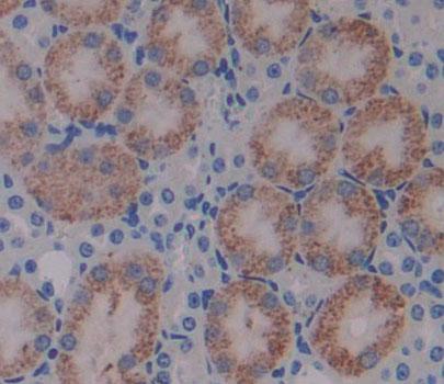 Polyclonal Antibody to 3-Hydroxyisobutyryl Coenzyme A Hydrolase (HIBCH)