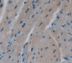 Polyclonal Antibody to Regulator Of G Protein Signaling 5 (RGS5)
