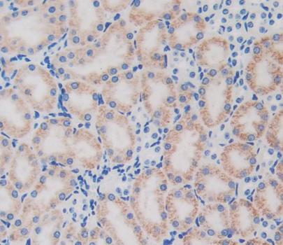 Polyclonal Antibody to Glutamate Cysteine Ligase, Catalytic (GCLC)