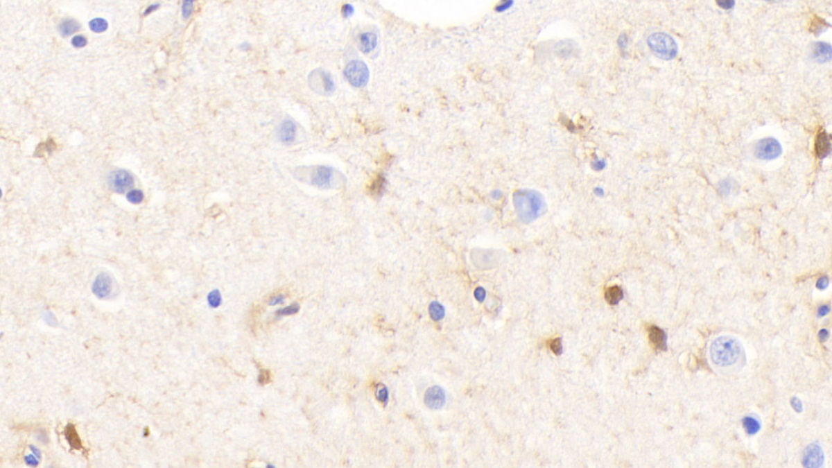 Polyclonal Antibody to Glutamine synthetase (GS)